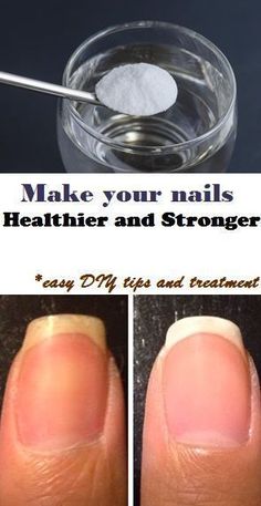 Split Nails, Nail Health, Diy Tips, Healthy Nails, Health And Beauty Tips, Beauty Treatments