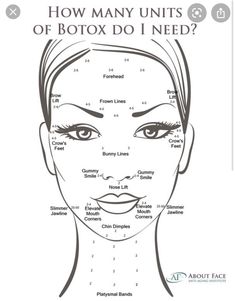 Botox Forehead, Facial Injections, Botox Lips, Facial Anatomy