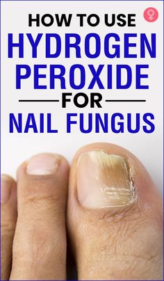 Peroxide Uses, Hydrogen Peroxide Uses, Nail Problems, Tongue Health, Home Health Remedies