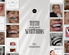 50 Teeth Whitening Social Media Posts for Aesthetic Clinics - Fully Customizable & Ready to Use Boost your clinic's Instagram presence with our premium collection of 50 fully customizable teeth whitening social media posts designed for aesthetic and dental clinics. These eye-catching posts are perfect for promoting your teeth whitening services, educating clients about the procedure, and showcasing before-and-after results to increase bookings and engagement. When you purchase, you'll receive a Teeth Whitening Aesthetic, Dental Clinic Ads, Dental Clinic Social Media, Cohesive Instagram Feed, Dental Marketing, Beauty Marketing, Tooth Gem, Aesthetic Clinic, Teeth Care