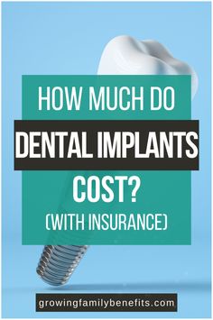 How much do dental implants really cost with insurance? It’s not as simple as you think, but there are ways to save. Find out what’s covered and how to manage costs—click to learn more! Dental Implants Cost, Medical Procedures, Dental Procedures, Dental Implant, Financial Assistance, Low Income, Dental Implants, Loans, Ways To Save