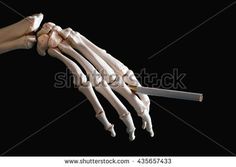 the bones of an arm and hand, with one bone exposed to the other side