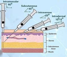 the diagram shows different types of sys and other medical instruments that can be used to treat or treat patients