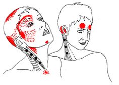 ROUND EARTH PUBLISHING Occipital Neuralgia, Referred Pain, Sinus Pain, Sinus Headache, Sinus Pressure, Head Pain