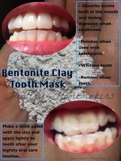 Bentonite Clay Bentonite Clay For Teeth, Clay Tooth, Bentonite Clay Benefits, Aztec Clay, Healthy Healing, Tooth Whitening, Teeth Whitening Remedies, Healing Clay, Whiten Teeth