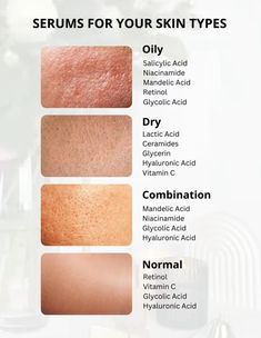 Skin Care Routine For Oily Skin, Oily Face Remedy, Acne Types, Oily Skin Face, Beauty Treatments Skin Care, Mekap Mata, Skin Care Basics, Face Skin Care Routine, Skin Care Routine Order