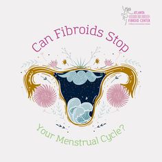 No, fibroids per se do not stop your menstrual cycle. The menstrual cycle can be disrupted, skipped, or even stopped due to hormonal imbalances which can be influenced by numerous factors... Hormonal Imbalances, The Menstrual Cycle, Irregular Periods, Hormone Imbalance, Canning, Pink