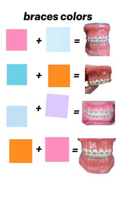 inspirational Best Braces Colors, Braces Hacks