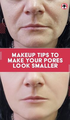 Enlarged Pores Remedies, Big Pores Makeup, Best Makeup For Large Pores, How To Make Your Pores Smaller, Large Pores How To Get Rid Of, Makeup For Large Pores, How To Minimize Pores, Best Primer For Pores, Large Pores Makeup