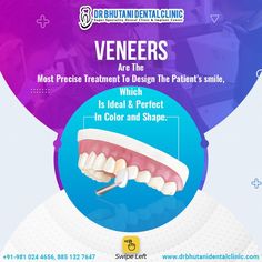 Veneers are great for protecting teeth from getting stained as well as enhancing their appearance - say goodbye to unattractive teeth stains! . 𝐁𝐨𝐨𝐤 𝐘𝐨𝐮𝐫 #appointment 𝐍𝐨𝐰 -𝟏𝟎𝟎% 𝐒𝐭𝐞𝐫𝐢𝐥𝐞 -𝟏𝟎𝐱 𝐒𝐚𝐟𝐞𝐭𝐲 . 𝐅𝐨𝐫 𝐀𝐩𝐩𝐨𝐢𝐧𝐭𝐦𝐞𝐧𝐭:- 📱:- +91-9810244656 . #DrBhutaniDentalClinic #bestdentist #veneers #dentaltreatment #rootcanal #rct #dentalhealth #dentaltreatment #dentalclinicindelhi #bestdentalclinicindelhi Stained Teeth, Root Canal