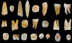 an assortment of different types of teeth on a black background