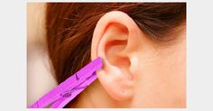 Accrocher une pince à linge à son oreille, la solution contre le mal de tête ? Ear Pressure Points, Ear Pressure, Joints Pain Relief, Reflexology, Acupressure, Natural Treatments, Natural Medicine, Acupuncture, Body Health