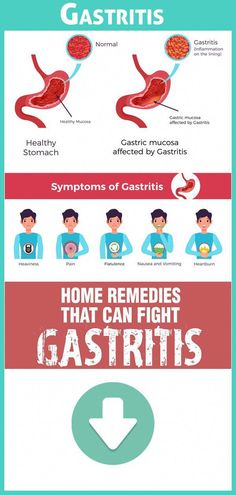 Millions of people around the world suffer gastritis on a daily basis.11 home remedies to cure and eliminate gastritis naturally. Healthful Foods, Gut Diet, Health Notes, Tummy Hurts, Human Organs, Reflux Diet, Natural Remedies For Migraines, Allergy Remedies, Dry Skin Remedies