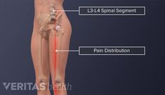 All About the L3-L4 Spinal Segment | Spine-health Morning Stiffness, Anatomical Illustration, Disk Herniation, Spine Health, Lower Back Pain, Low Back Pain, Red Line, Sciatica, Emergency Medical