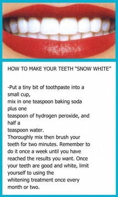 #WhoDefinitionOfOralCare #WhatIsTheBestOralCareRoutine Obličejové Masky, Teeth Whitening Diy, Natural Teeth Whitening, Natural Teeth, Beauty Remedies, Teeth Care, White Teeth, Health And Beauty Tips, Beauty Treatments