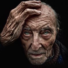 an old man with wrinkles and blue eyes is holding his hands to his head