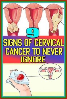 7 warning symptoms of  - cervical cancer that every women should know by Steven Johnston | This newsletter was created with Smore, an online tool for creating beautiful newsletters for educators, businesses and more Health Signs, Oral Health, Oral Care, Parenting Hacks, Health Tips, Parenting