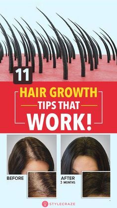 Indian Hair Growth Secrets, Thicker Hair Naturally, Grow Thicker Hair, Get Thicker Hair, Healthy Natural Hair Growth, Make Hair Grow, Natural Hair Growth Tips