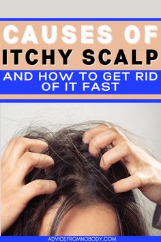 Causes Of Dandruff, Soothe Itchy Scalp, How To Help Itchy Scalp, Flaky Hair Remedies Dry Scalp, Scalp Dryness Remedies, Best Oil For Dry Scalp, Dandruff And Itchy Scalp Remedy, Sensitive Scalp Remedies