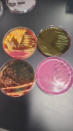 E. coli culture on MacConkey, EMB, XLD, and HE agar.   MLT ~ Medical Laboratory Technician ~ Clinical Microbiology ~ Bacteria Cultures  #mlt #microbiology #ecoli #microculture #bacteria #study #stem Clinical Microbiology, Uni Motivation, Biology Labs, Lab Safety