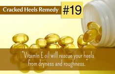 Cracked heels are the result of dry, callused skin on the bottom of your feet.They can be extremely painful. Here is the list of home remedies for cracked heels Dry Feet Remedies, Body Tricks, Skin Tags On Face, Beauty Diy Skincare, Dry Heels, Healing Remedies, Face Scrub Homemade