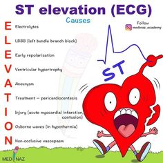 St Elevation, Nerdy Nurse, Doctor Quotes Medical, Brain Surgeon