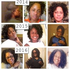 Locs Journey, Micro Locs, Naturally Beautiful, Locs, Cute Nails