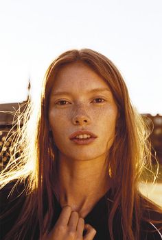 a woman with freckles on her face posing for a photo in the sun