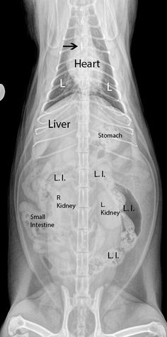 an x - ray shows the location of the heart and livers in the lower body