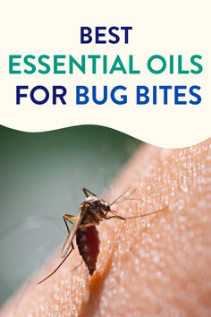 Here's a list of the top essential oils for bug bites. They work great to soothe itchy, irritated skin caused by mosquito bites or other insects. Essential Oils For Bug Bites, Oils For Bug Bites, Mosquito Repellent Essential Oils, Natural Medicines, Top Essential Oils, Emergency Essentials, Mosquito Bites, Essential Oils Gifts, Essential Oil Mixes