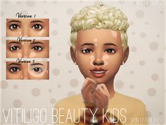 peachtreees' Vitiligo Beauty Skin Overlay KIDS N3 The Sims 4 Kids, Sims 4 Children, Sims 4 Body Mods