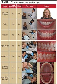 Guide to Dental Photography - Decisions in Dentistry Dental Anatomy Study, Dental Notes, Dental Pictures