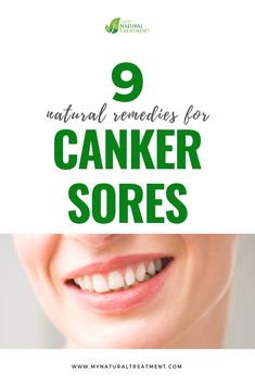 9 Natural Remedies for Canker Sores - Canker Sores Remedy #cankersores #cankersore #cankersoreremedies #cankersoreremedy #cankersoretreatment #cankersorecure #treatcankersore #healcankersore Sore Gums Remedy, Canker Sore On Tongue, Gum Sores, Canker Sore Remedy, Tongue Sores, Amazing Home, Holistic Healing