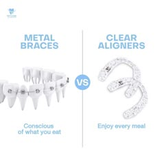 Invisible Braces Teeth, Clear Aligners Ads, Clear Aligner, Transparent Braces, Invisalign Attachments, Light Blue Power Chain Braces, Invisalign Braces, Invisible Braces