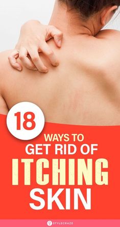 Face Itching Remedies, Itchy Rash Remedies, Itchy Skin Remedies Itch Relief, Itching Remedies Skin, Itching Skin Remedies, Itchy Skin Causes, Dry Itchy Skin Remedies, Itchy Skin Remedies, Remedy For Itchy Skin