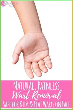 When my son was 8 years old I noticed that he had a few warts on his fingers. It wasn’t a big deal and I wasn’t too concerned about them. But after a while, I noticed a few more as the warts started to spread. Thankfully I found a natural wart removal treatment that got rid of the warts and they haven't been back! Flat Warts, Types Of Warts, Warts On Hands, Warts On Face, Home Remedies For Warts, Remove Skin Tags Naturally, Warts Remedy, Remove Warts, Skin Moles