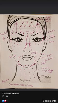 Face Injections, Botox Injection Sites, Facial Injections, Face Fillers, Botox Lips, Aesthetic Dermatology, Botox Cosmetic, Botox Face, Face Mapping