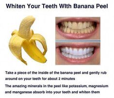 Banana Peel Teeth Whitening, Natural Teeth Whitening Remedies, Banana Uses, Banana Benefits