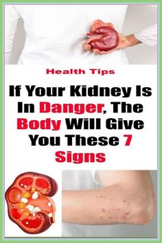 If Your Kidney Is in Danger - Body Will Give You These 7 Signs! by Dusan Canevski | This newsletter was created with Smore, an online tool for creating beautiful newsletters for educators, businesses and more Elizabeth Miller, Diet Schedule, Magnesium Deficiency, Creating A Newsletter, Health Planner, Health Remedies, Health Problems