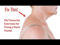 an image of a man's neck and shoulder with the words fix this on it