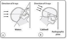 a diagram showing the different types of x - rays and radiographic plates in human head