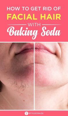 Benefits Of Baking Soda, Baking Soda For Hair, Oreo Cheesecake, Beauty Tips For Skin, Unwanted Hair Removal, Natural Beauty Tips