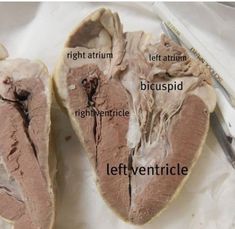 the left side of an open heart with different parts labeled