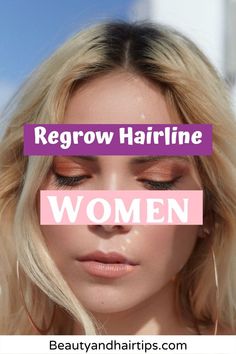 Regrow Hairline Women: There are three important ways in which anyone especially a female can regrow your thinning hair and recover your hair loss. When both natural remedies and medical treatments fall short, women can also opt for cosmetic procedures to make up for the loss of their hair. Hair transplantation surgery is often conducted as an outpatient surgical procedure. #RegrowHairlineWomen | Hair Loss cure guide| Regrow hair naturally| Regrow hair naturally remedies| Hair loss| hair| Hair Shedding Remedies, Hair Regrowth Women, Natural Hair Growth Remedies, Brown Spots On Face