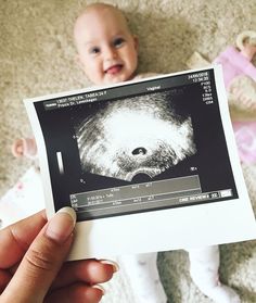 a baby is being held up to the camera by someone's hand with an x - ray image on it