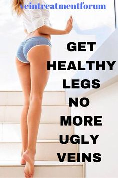 a woman is standing on some stairs with her legs up and the words get healthy legs no more ugly veins