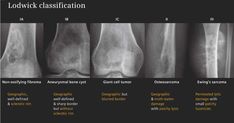 Ultrasound Sonography, Radiology Imaging, Anatomy Bones, Radiology Technologist, Bone Diseases, Medical Imaging, Medical Assistant