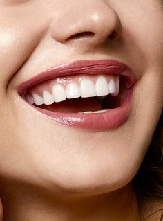 a close up of a woman's mouth with white teeth