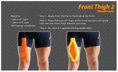 Kinesiology taping instructions for the front thigh #ktape #thigh #ares Sports Taping, Knee Taping, Sport Injuries, Kt Tape, Kinesiology Taping