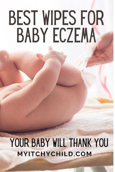 Baby Excema, Baby Skin Care Products, Baby Bath Products, Toxic Products, Soothing Baby, Baby Soap, Eco Friendly Baby, Baby Skin Care